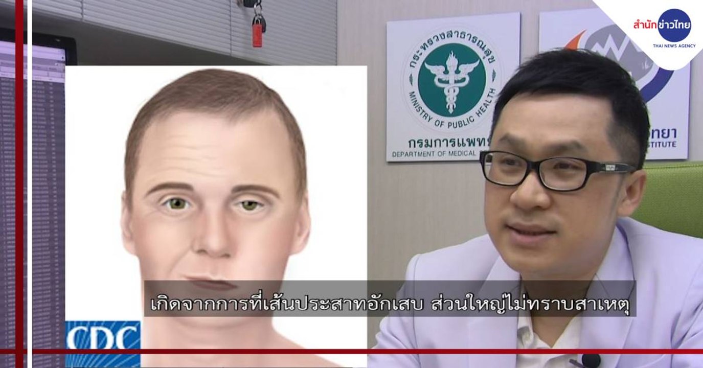 ชัวร์ก่อนแชร์ FACTSHEET : กดนวดแก้มหรือขมับ ทำให้ปากเบี้ยวได้ จริงหรือ?