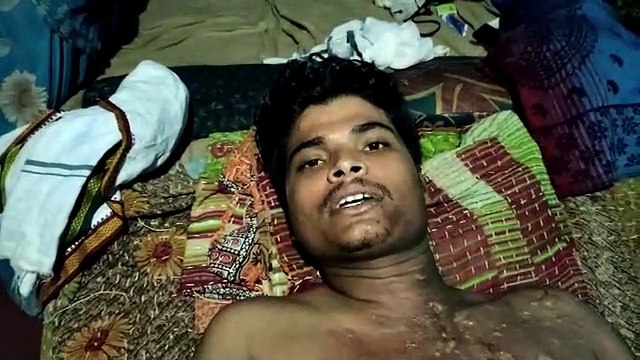 मोबाइल की बैटरी फटने से रिपेयरिंग का कार्य करने वाला व्यक्ति गंभीर घायल, अस्पताल में इलाज जारी