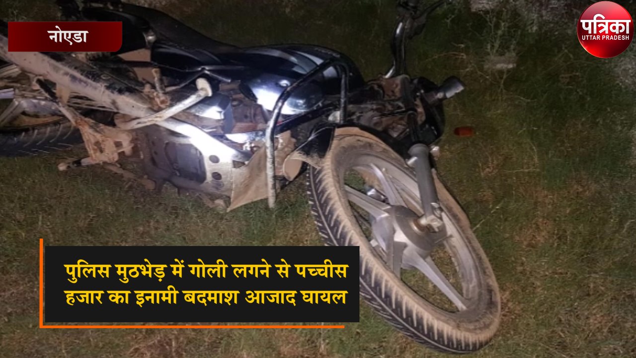पुलिस मुठभेड़ में पच्चीस हज़ार का इनामी बदमाश आजाद घायल