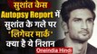 Sushant Rajput Case : Autopsy Report में सुशांत के गले पर 'लिगेचर मार्क' मिला | वनइंडिया हिंदी