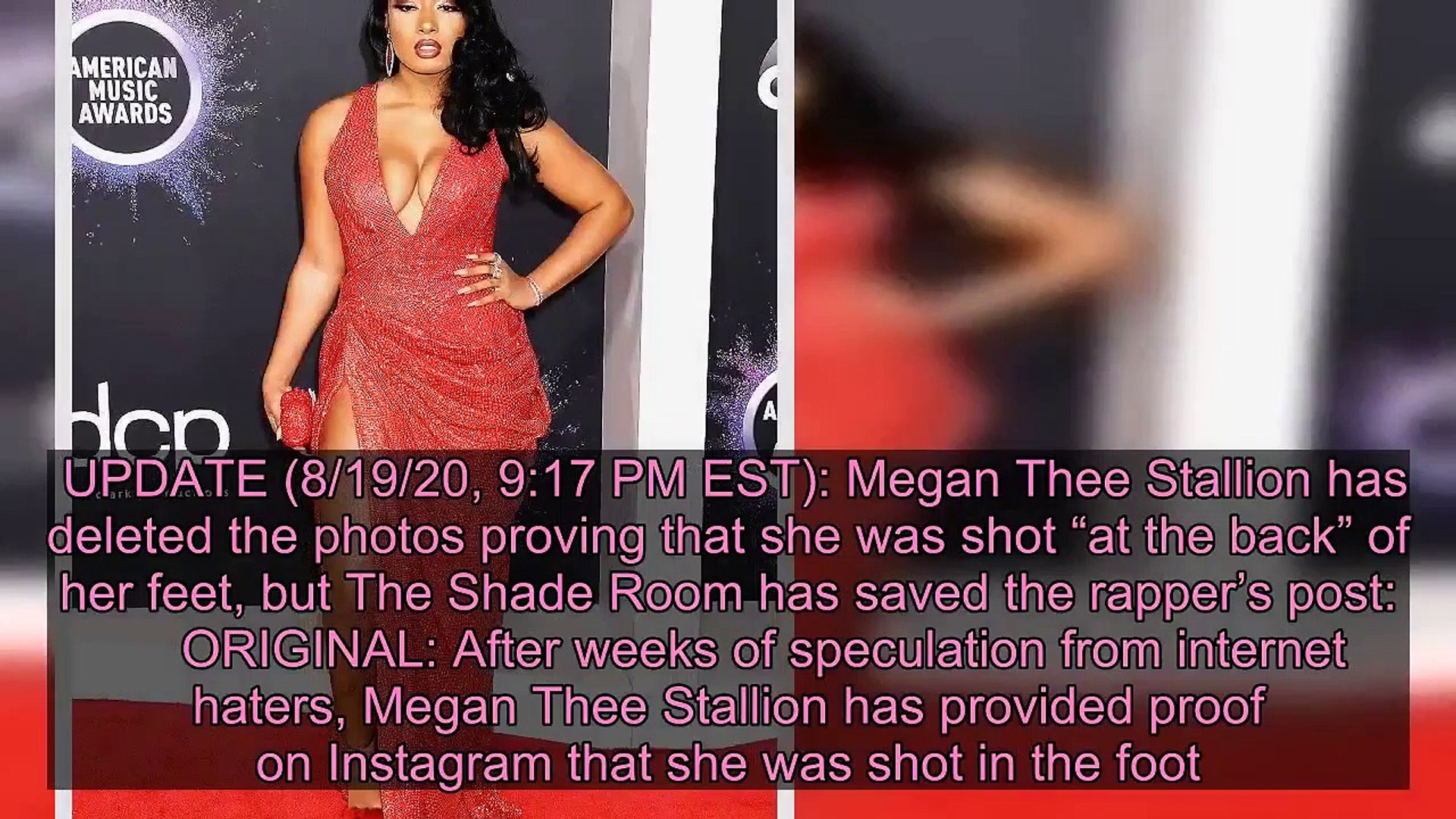 Megan Thee Stallion Reveals Stitches and Sets Record Straight On Getting Shot — Pics - Live News 24