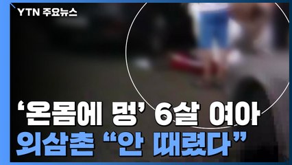 '온몸에 멍 자국' 6살 여아 숨져...함께 살던 외삼촌 "안 때렸다" / YTN