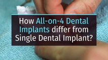 Traditional Dental Implants Vs. All-on-4 Dental Implants