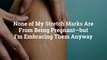 None of My Stretch Marks Are From Being Pregnant—but I'm Embracing Them Anyway