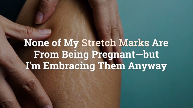 None of My Stretch Marks Are From Being Pregnant—but I'm Embracing Them Anyway