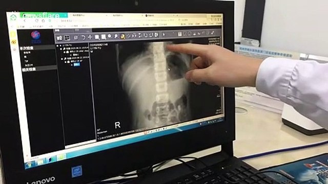 Chinese doctor removes 18-centimetre-long pencil from boy's stomach