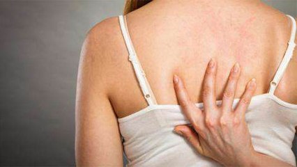 Back Acne Treatment: पीठ पर दाने निकलने के कारण | पीठ पर दाने क्यों होते है | Boldsky