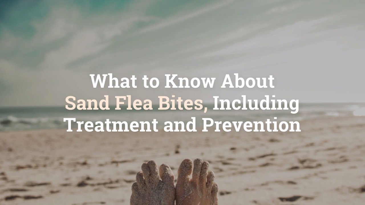 What to Know About Sand Flea Bites, Including Treatment and Prevention