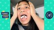 Wisdom Teeth Aftermath Reaction Compilation 2017 _ Funny Vines