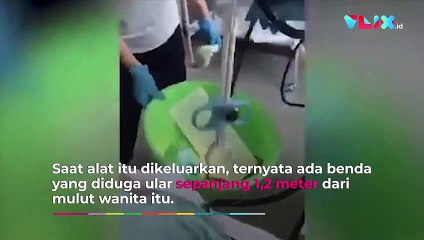 Dokter Sampai Jijik! Ular 1,2 Meter Masuk Mulut Pas Tidur