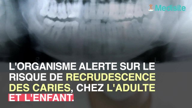 Les dentifrices sans fluor augmentent vos risques de caries