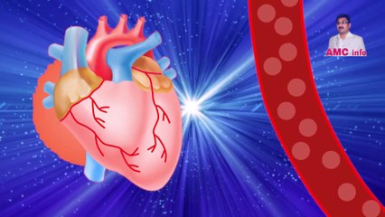 Tips for heart health | Kick out Heart Attack and Angina pain| Dil Ki Sehat || Urdu, Hindi||AMC info