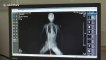 Doctor removes 80-centimetre-long rebar from woman's body in China