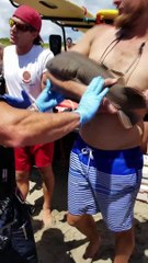 Baby Nurse Shark Latched onto Mans Arm at Beach