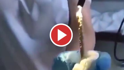 Le extraen una serpiente enorme de las entrañas