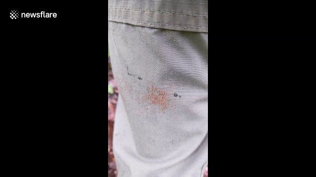 'Tick bomb' sees hundreds of baby insects crawl on Missouri man's leg