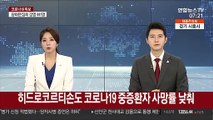 히드로코르티손도 코로나19 중증환자 사망률 낮춰