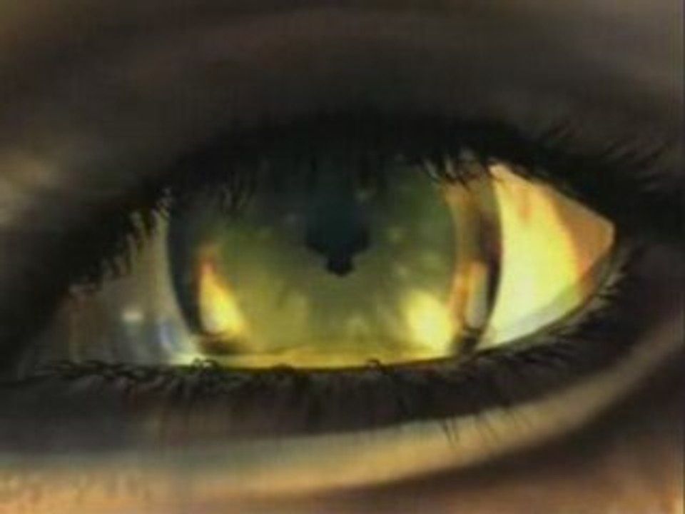 Avant que l'ombre remix