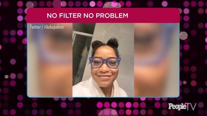 Keke Palmer Shares Filter-Free Selfie to Celebrate Her Clear Skin After Acne Struggles