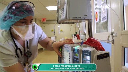 Fotos mostram o novo coronavírus nas vias aéreas