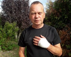 Mordu par une araignée exotique dans la nuit, il manque de se faire amputer le bras