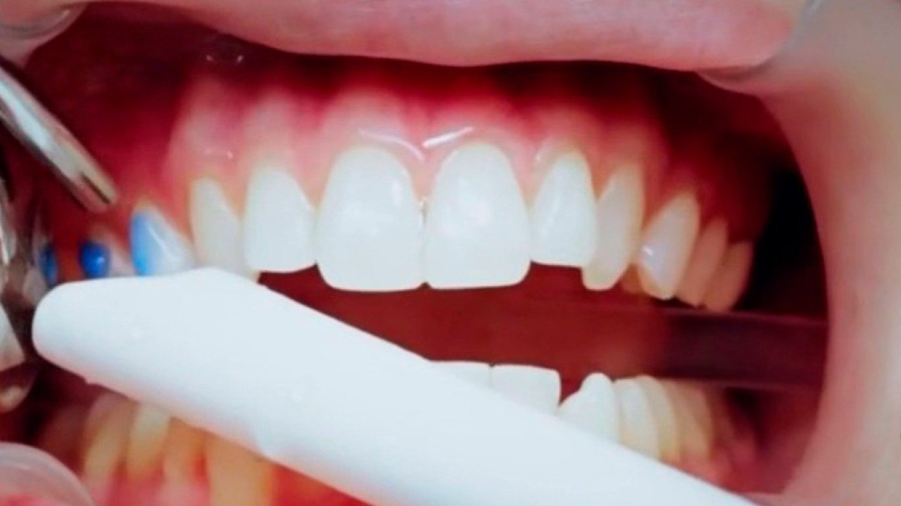 bd-alternativas-para que-sus-dientes-se-vean-mas-blancos-040920