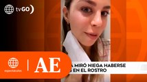 Alondra García Miró negó cirugías en su rostro | América Espectáculos (HOY)