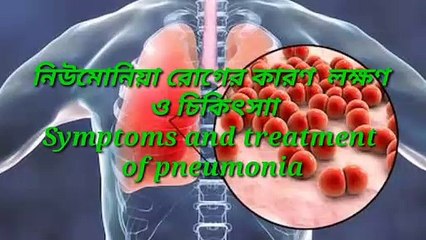 _Symptoms_and_treatment_of_pneumonia  নিউমােনিয়া_রােগের_কারণ__লক্ষণ_ও_চিকিৎসাা