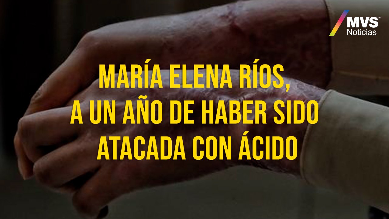 María Elena Ríos, a un año de haber sido atacada con ácido - Vídeo ...