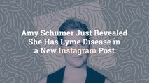 Amy Schumer Just Revealed She Has Lyme Disease in a New Instagram Post