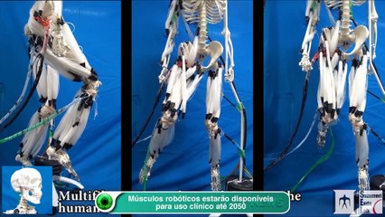 Músculos robóticos estarão disponíveis para uso clínico até 2050