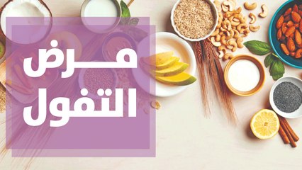 التغذية المناسبة لمرضى التفول