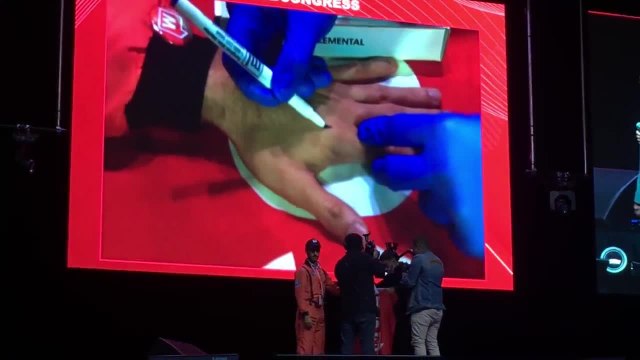 VIDEO: así hicieron el primer implante de microchip en una persona en Colombia