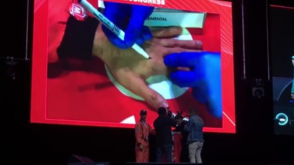 VIDEO: así hicieron el primer implante de microchip en una persona en Colombia