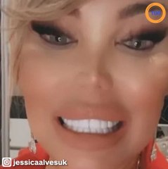 Jessica Alves, ancienne “poupée humaine Ken” dévoile une opération du menton bâclée