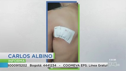 Joven resultó herido en medio de atraco en el norte de Bogotá