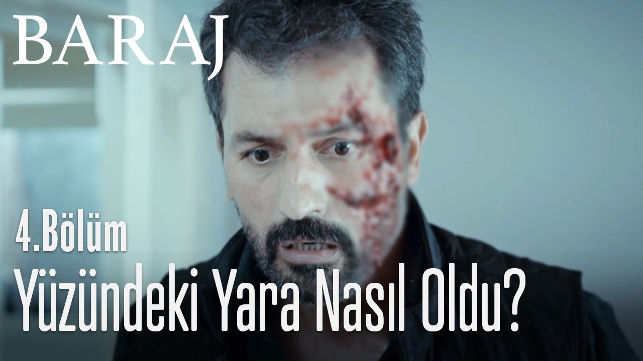 Nazım'ın yüzündeki yara izinin sırrı - Baraj 4. Bölüm