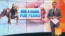 Menor resultó con graves heridas al ser atacada por un perro en Bogotá