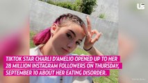 Tiktok Star Charlie D’Amelio Reveals She Has An Eating Disorder