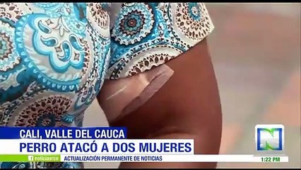 Dos mujeres fueron atacadas por un perro de raza Bull Terrier en Cali