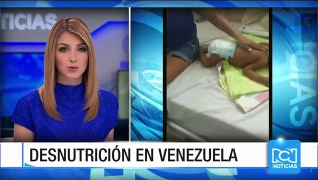 Asciende a 13 el número de menores fallecidos por desnutrición en Venezuela durante 2017