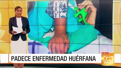 Télécharger la video: RCN Contigo: EPS Cafesalud no cumple con tratamiento de joven con esclerosis tuberosa