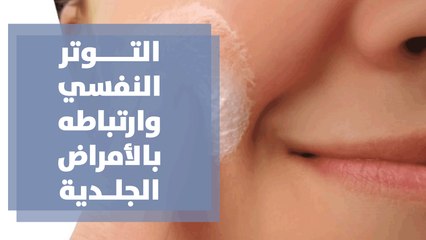 التوتر النفسي وارتباطه بالأمراض الجلدية