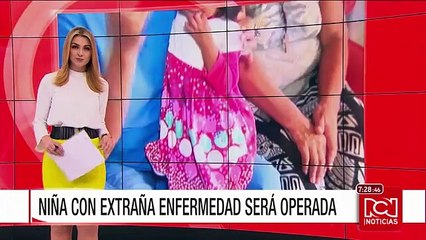 Niña que padece síndrome de 'huesos de cristal' por fin será operada