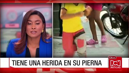 Una niña de ocho años fue atacada por un perro criollo en Barranquilla