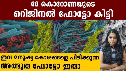 Scientists Publishes Images Of Coronavirus Infected Cells | Oneindia Malayalam