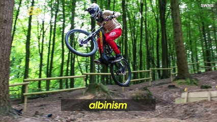 Blind Mountain Biker Defies Odds, Chases Dream of Riding Professionally