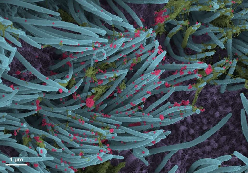 Covid-19 : les images saisissantes du SARS-CoV-2 dans nos cellules