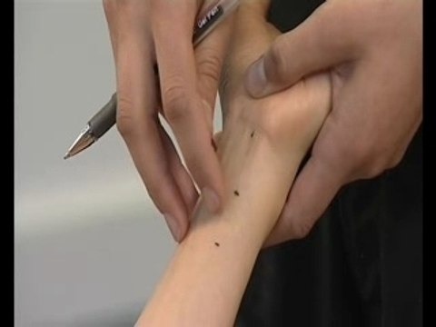 Acupuncture DVD - How to Locate Acupuncture Points