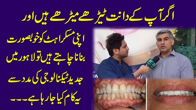 Agr ap k dant terhay merhay Hain aur apni muskurahat ko khubsurat bnana chahty Hain to Lahore me jadeed technology ki madad se ye Kam Kia ja Raha hai..